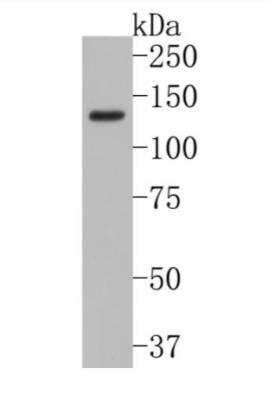 Western Blot: Leptin R Antibody (JA73-01) [NBP2-66931]