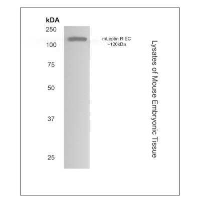 Western Blot: Leptin R Antibody (RM0085-9C29)Azide and BSA Free [NBP1-21725]