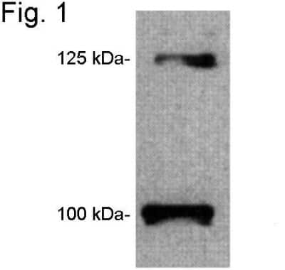 Western Blot: Leptin R Antibody [NB120-5593]