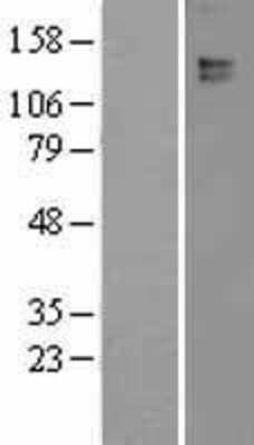 Western Blot: Leptin R Overexpression Lysate [NBL1-12490]