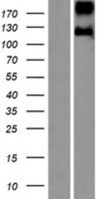 Western Blot: Leptin R Overexpression Lysate [NBP2-10740]