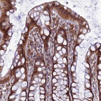 Immunohistochemistry-Paraffin: Leucyl-cystinyl Aminopeptidase/LNPEP Antibody [NBP1-92071]