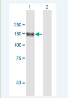 Western Blot: Leucyl-cystinyl Aminopeptidase/LNPEP Antibody [H00004012-B01P-50ug]