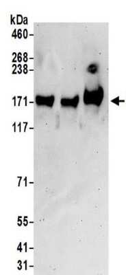 Western Blot: Leucyl-cystinyl Aminopeptidase/LNPEP Antibody [NBP2-32111]