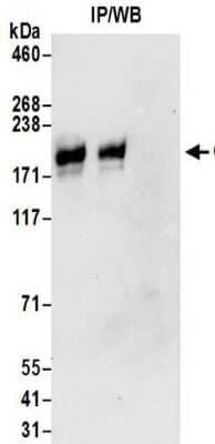 Western Blot: Leucyl-cystinyl Aminopeptidase/LNPEP Antibody [NBP2-32111]