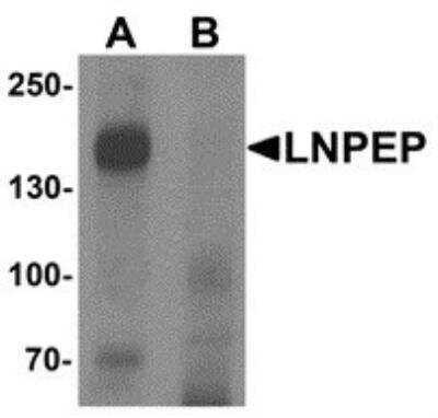 Western Blot: Leucyl-cystinyl Aminopeptidase/LNPEP AntibodyBSA Free [NBP2-81854]