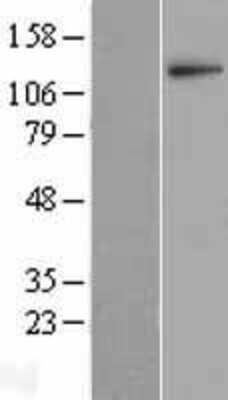 Western Blot: Leucyl-cystinyl Aminopeptidase/LNPEP Overexpression Lysate [NBL1-12570]