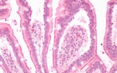 Immunohistochemistry-Paraffin: Leukotriene B4 Receptor 2 Antibody [NBP3-14390]