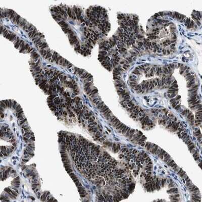 Immunohistochemistry-Paraffin: Leukotriene A4 Hydrolase/LTA4H Antibody [NBP1-90368]