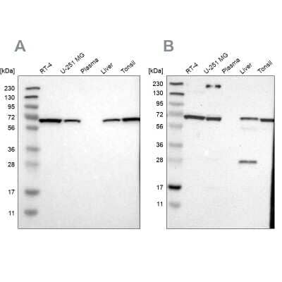 Western Blot: Leukotriene A4 Hydrolase/LTA4H Antibody [NBP1-90368]