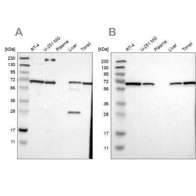 Western Blot: Leukotriene A4 Hydrolase/LTA4H Antibody [NBP1-90375]