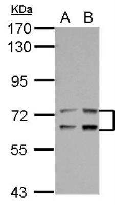 Western Blot: Leukotriene A4 Hydrolase/LTA4H Antibody [NBP2-19347]