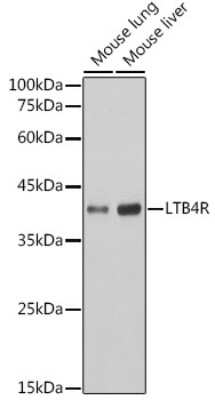 Western Blot: Leukotriene B4 R1 Antibody (4R2X8) [NBP3-15458]