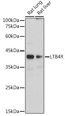 Western Blot: Leukotriene B4 R1 Antibody (4R2X8) [NBP3-15458]
