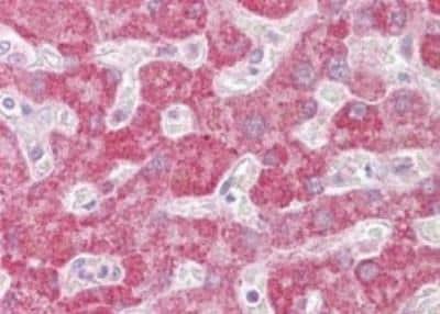 Immunohistochemistry-Paraffin: Leukotriene B4 R1 Antibody [NBP2-27422]