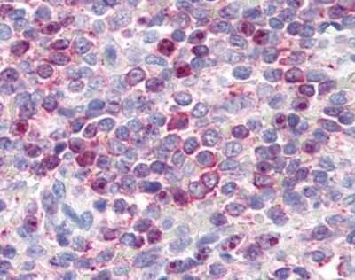 Immunohistochemistry-Paraffin: Leukotriene B4 R1 Antibody - BSA Free [NLS1492]