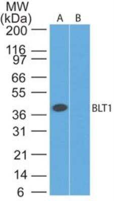 Western Blot: Leukotriene B4 R1 Antibody [NBP2-27422]