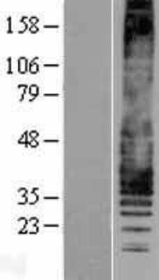 Western Blot: Leukotriene B4 R1 Overexpression Lysate [NBP2-11364]