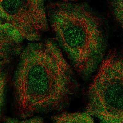 Immunocytochemistry/ Immunofluorescence: Leukotriene B4 Receptor 2 Antibody [NBP2-57352]