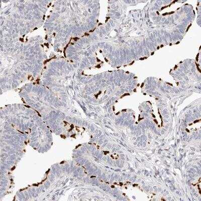 Immunohistochemistry-Paraffin: Leukotriene B4 Receptor 2 Antibody [NBP1-89960]