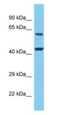 Western Blot: Leukotriene B4 Receptor 2 Antibody [NBP3-09429]