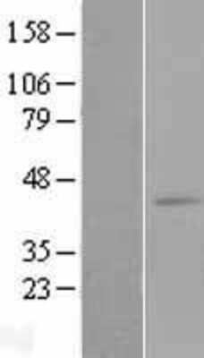 Western Blot: Leukotriene B4 Receptor 2 Overexpression Lysate [NBL1-12739]