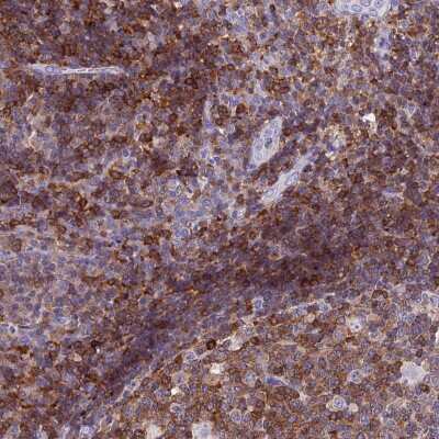 Immunohistochemistry-Paraffin: Leupaxin Antibody [NBP2-31078]