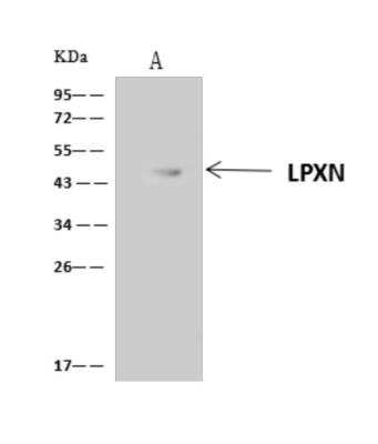 Immunoprecipitation: Leupaxin Antibody [NBP3-06271]