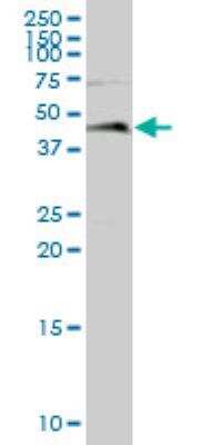 Western Blot: Leupaxin Antibody [H00009404-B01P]
