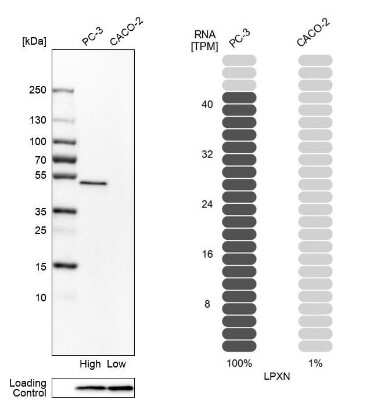 Western Blot: Leupaxin Antibody [NBP2-31078]