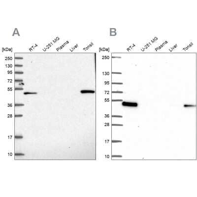 Western Blot: Leupaxin Antibody [NBP2-31078]