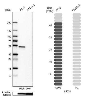 Western Blot: Leupaxin Antibody [NBP2-55850]