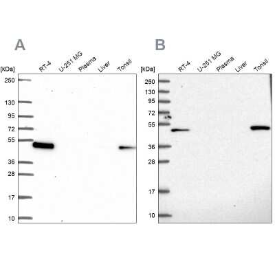 Western Blot: Leupaxin Antibody [NBP2-55850]