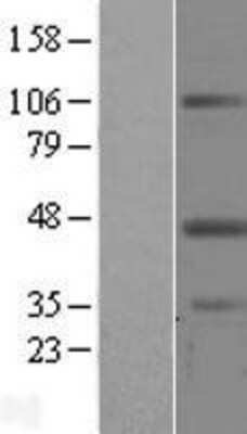 Western Blot: Leupaxin Overexpression Lysate [NBL1-12658]