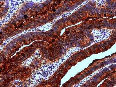 Immunohistochemistry: Lewis A Blood Group Antigen Antibody (7LE) - BSA Free [NB500-525]