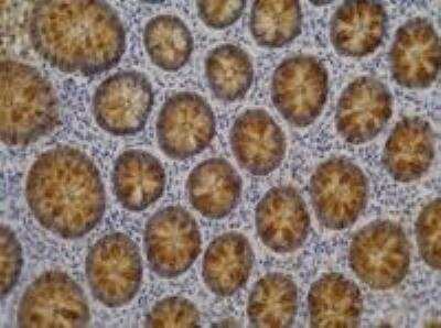Immunohistochemistry-Paraffin: Lewis A Blood Group Antigen Antibody (7LE) - BSA Free [NB500-525]