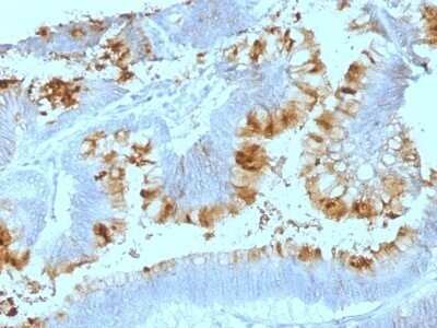 Immunohistochemistry-Paraffin: Lewis A Blood Group Antigen Antibody (SPM522) - IHC-Prediluted [NBP2-48080]