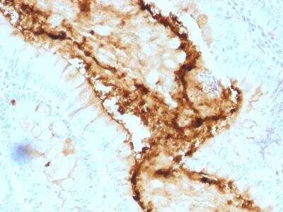 Immunohistochemistry-Paraffin: Lewis Y Antibody (A70-A/A9) [NBP2-50073]