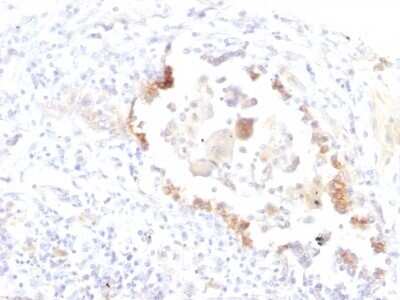 Immunohistochemistry-Paraffin: Lewis Y Antibody (LWY/1463) [NBP2-53216]