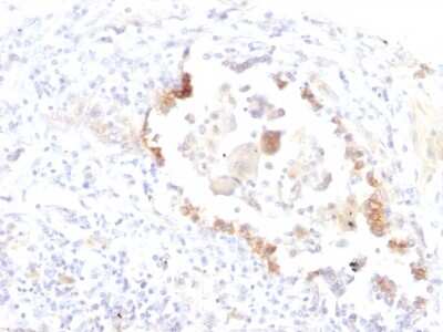 Immunohistochemistry-Paraffin: Lewis Y Antibody (LWY/1463) - Azide and BSA Free [NBP2-54560]