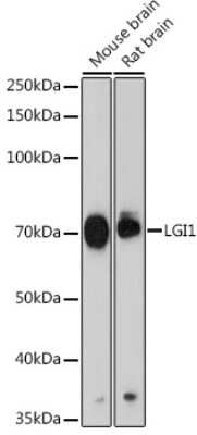 Western Blot: Lgi1 Antibody (2P8Z9) [NBP3-15694]