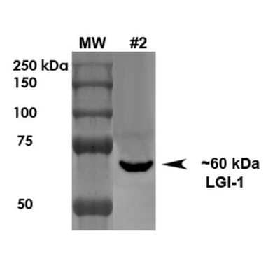 Western Blot: Lgi1 Antibody (S283-7) [NBP2-42190]