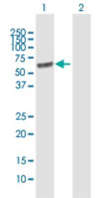 Western Blot: Lgi1 Antibody [H00009211-B01P]