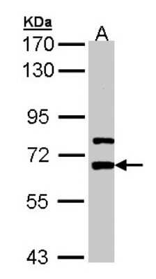 Western Blot: Lgi1 Antibody [NBP1-33087]