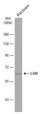 Western Blot: Lgi1 Antibody [NBP1-33087]