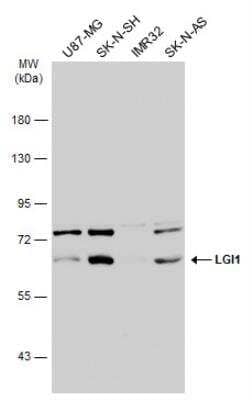 Western Blot: Lgi1 Antibody [NBP1-33087]