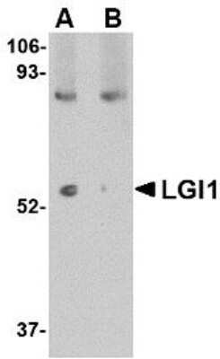 Western Blot: Lgi1 AntibodyBSA Free [NBP1-76379]