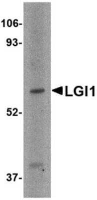 Western Blot: Lgi1 AntibodyBSA Free [NBP1-77320]