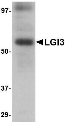 Western Blot: Lgi3 AntibodyBSA Free [NBP1-76383]