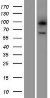 Western Blot: Lgi3 Overexpression Lysate [NBP2-05574]